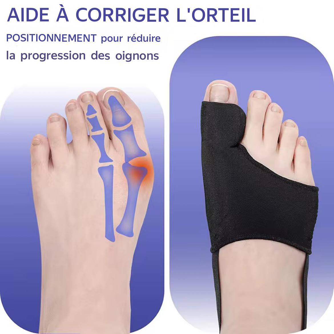 correcteur d’oignon (ou hallux valgus) 👣
