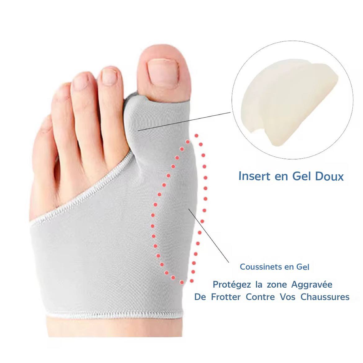 correcteur d’oignon (ou hallux valgus) 👣