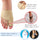 correcteur d’oignon (ou hallux valgus) 👣