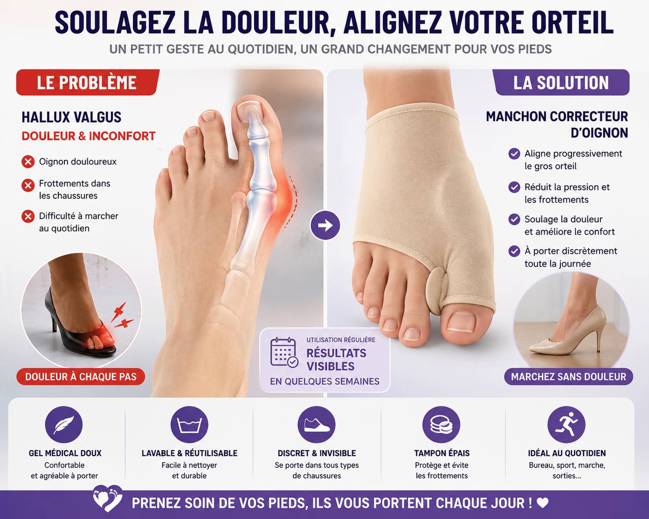 Correcteur d'orteils AJB